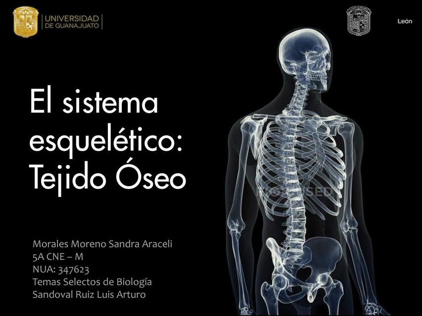 El Sistema Esquel Tico Tejido Seo Udocz