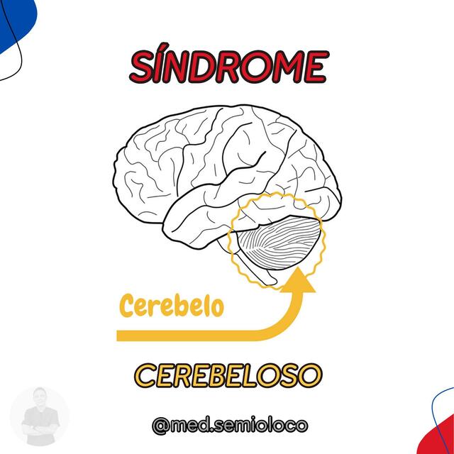 S Ndrome Cerebeloso V Ctor Rodriguez Botero Med Semioloco Udocz