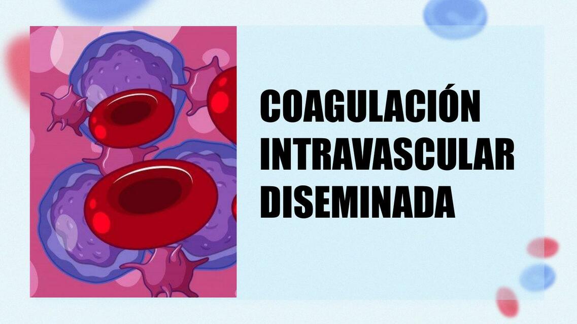 Coagulación Intravascular Diseminada gigivth uDocz