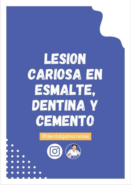 LESION CARIOSA EN ESMALTE DENTINA Y CEMENTO Dentalgama Notes UDocz