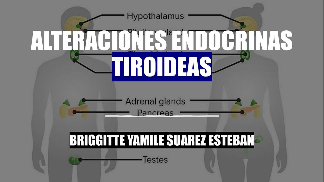 Fisiopatología de las alteraciones endocrinas tiroideas Briggitte