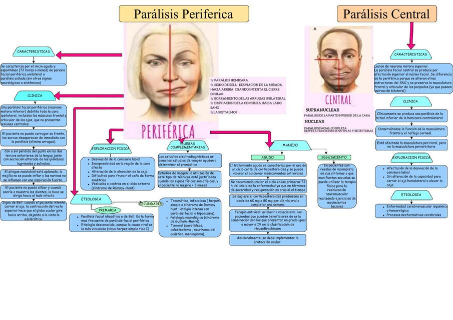 Paralisis Central Y Perif Rica Marco Og Udocz