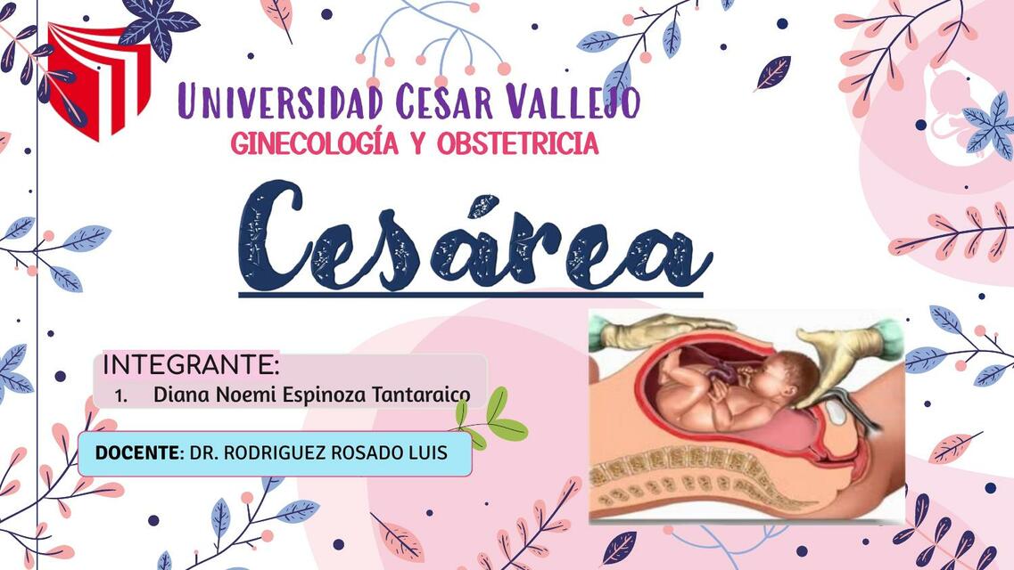 Cesarea 2