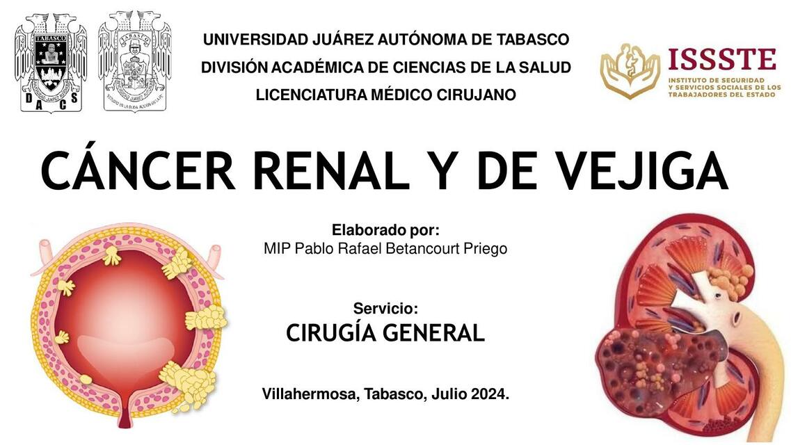 CANCER RENAL Y DE VEJIGA