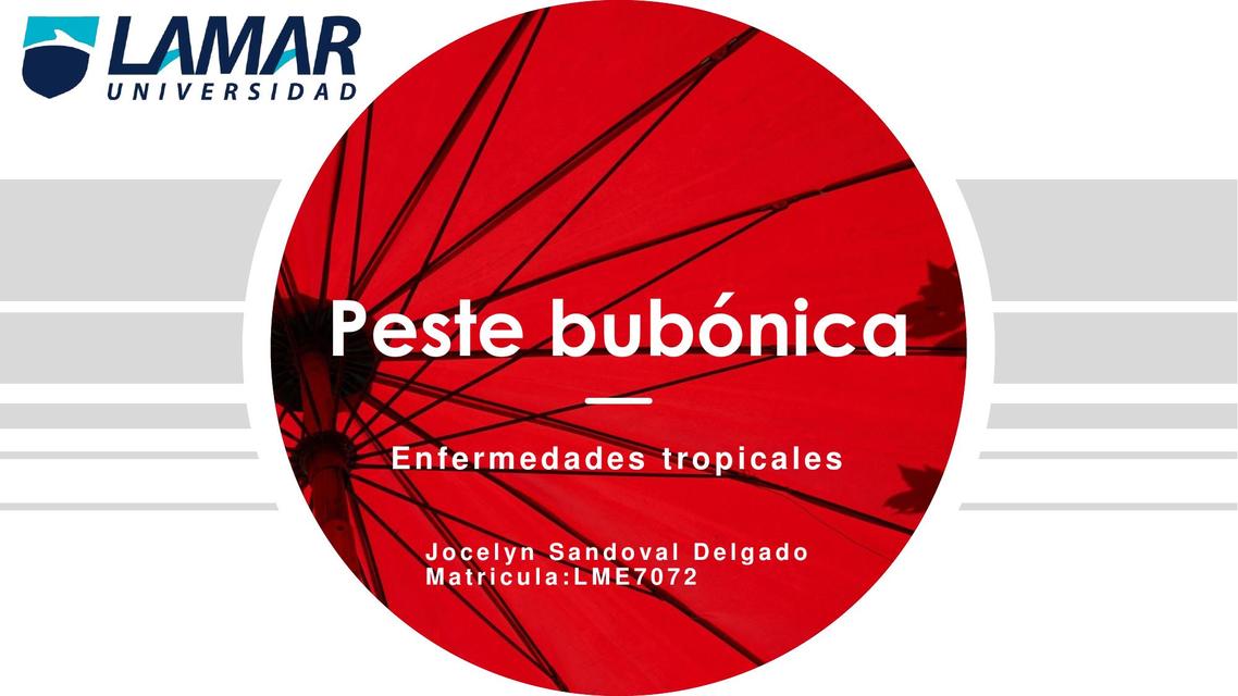 Peste bubónica