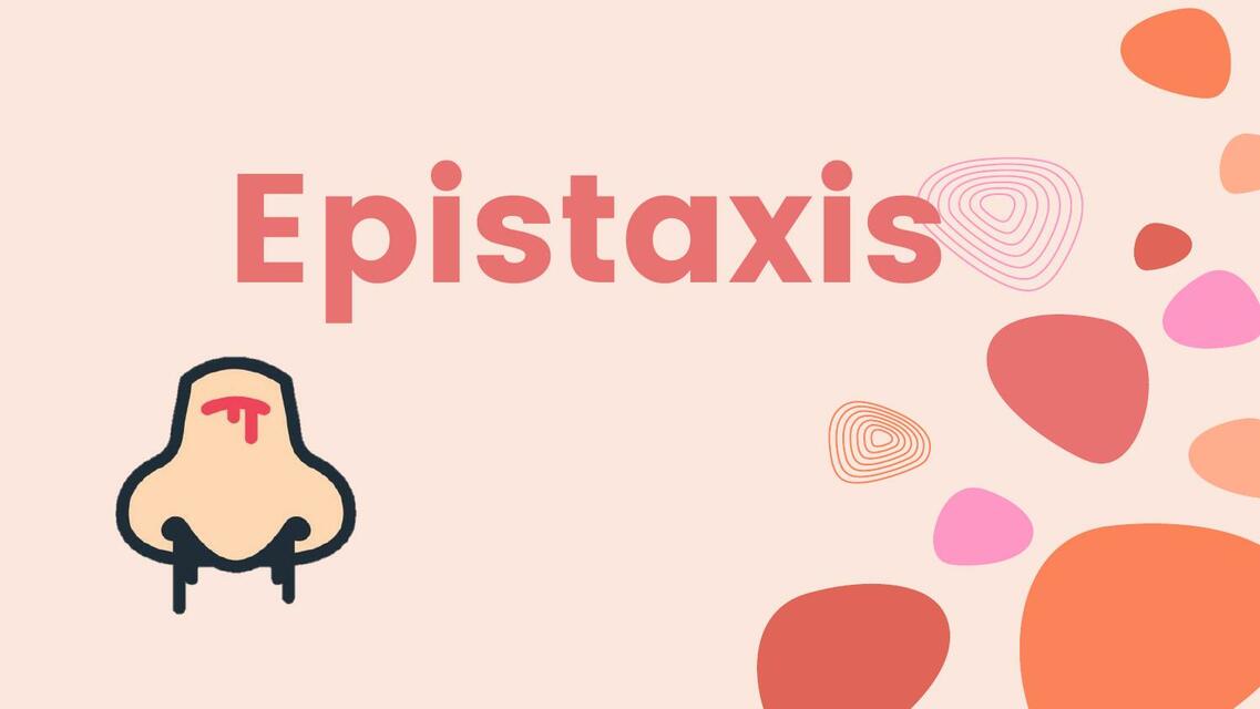 Epistaxis