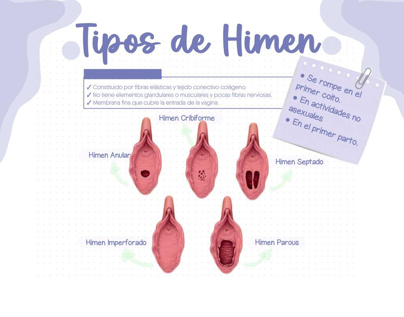 Tipos De Himen Obstetrix Notes UDocz Tipos De Himen Obstetrix Notes UDocz