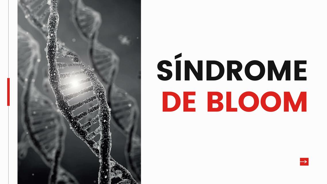 Síndrome de bloom