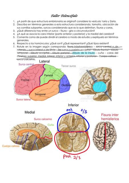 Taller TELENCEFALO