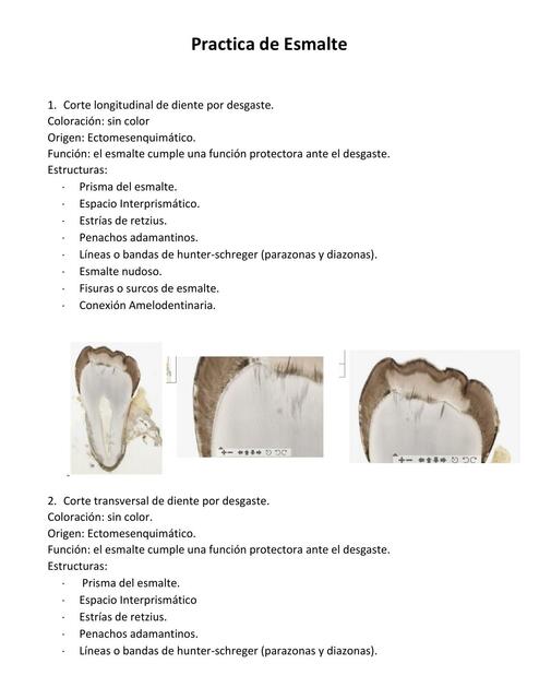 Practica de Esmalte