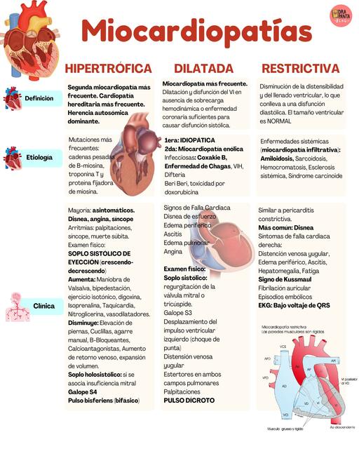 Miocardiopatías