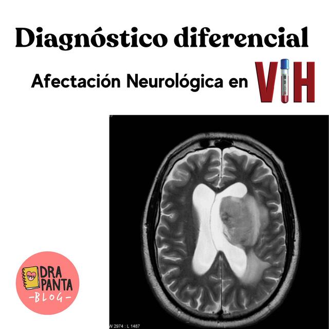 AFECTACIÓN NEUROLÓGICA EN VIH