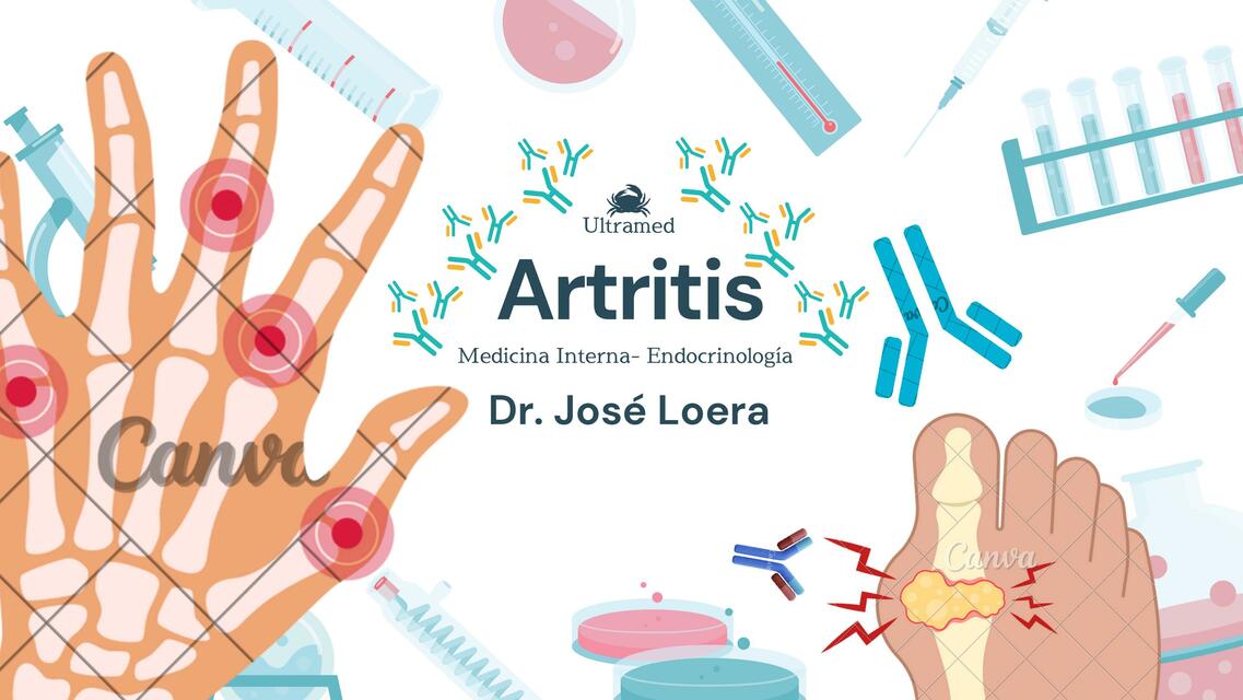 ARTRITIS REUMATOIDE