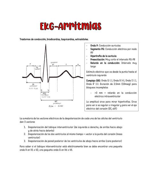 EKG Arritmias