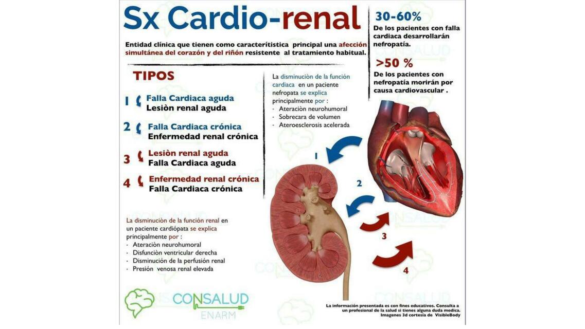 Sindrome cardiorenal