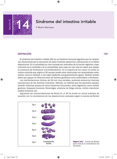 Síndrome del intestino irritable 