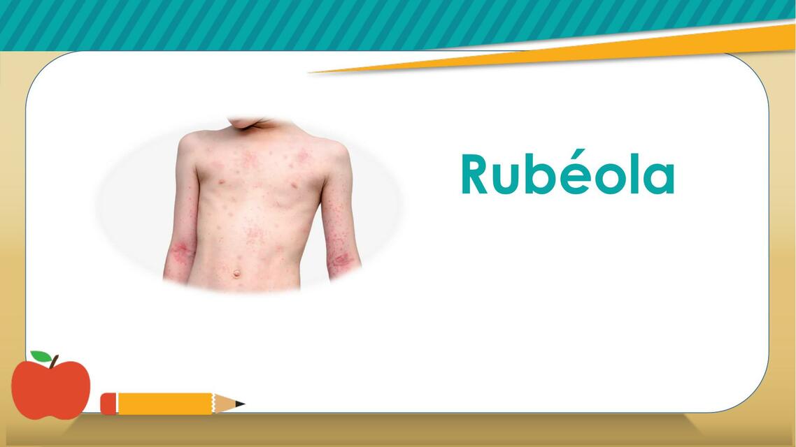 Fruth Rubeola Presentacion sobre Rubeola | Celeste Codutti | uDocz