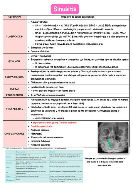 Sinusitis - pediátria