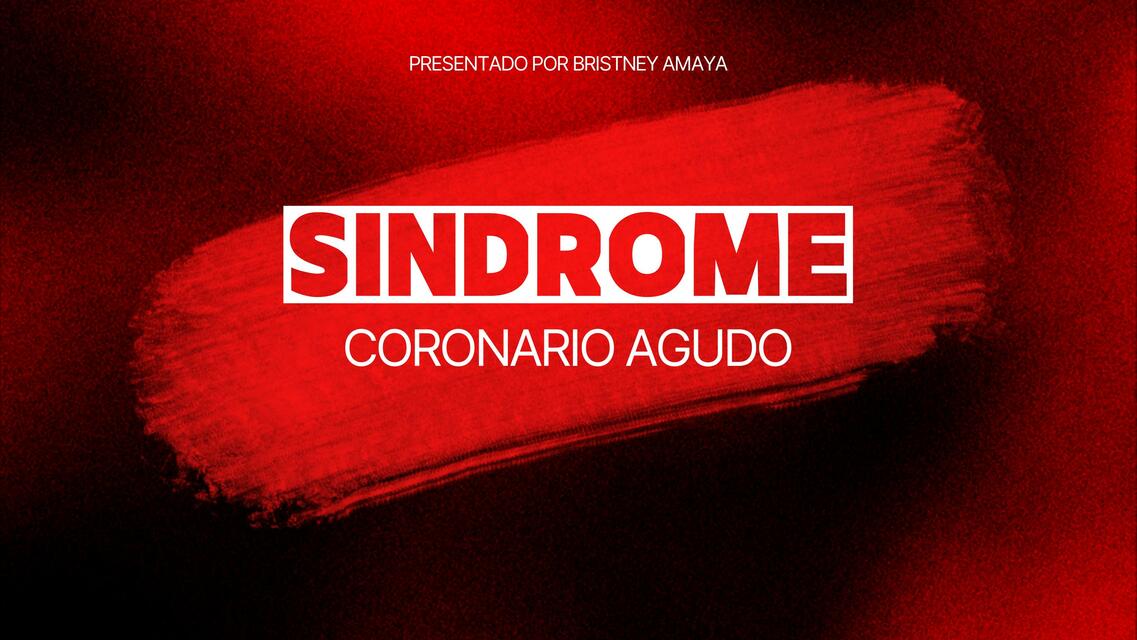 SÍNDROME CORONARIO AGUDO (SCA)