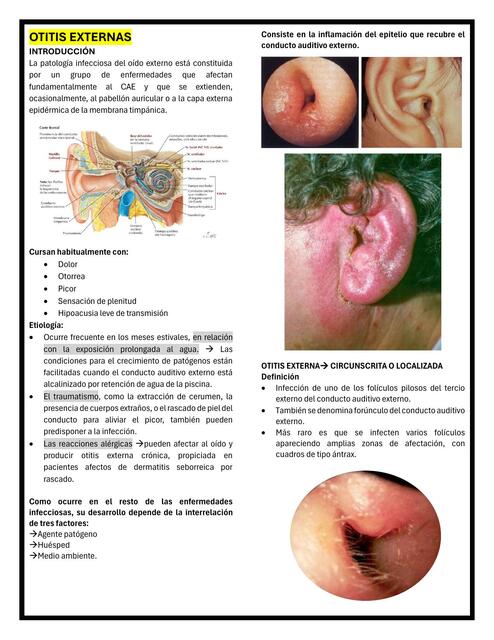 OTITIS EXTERNAS