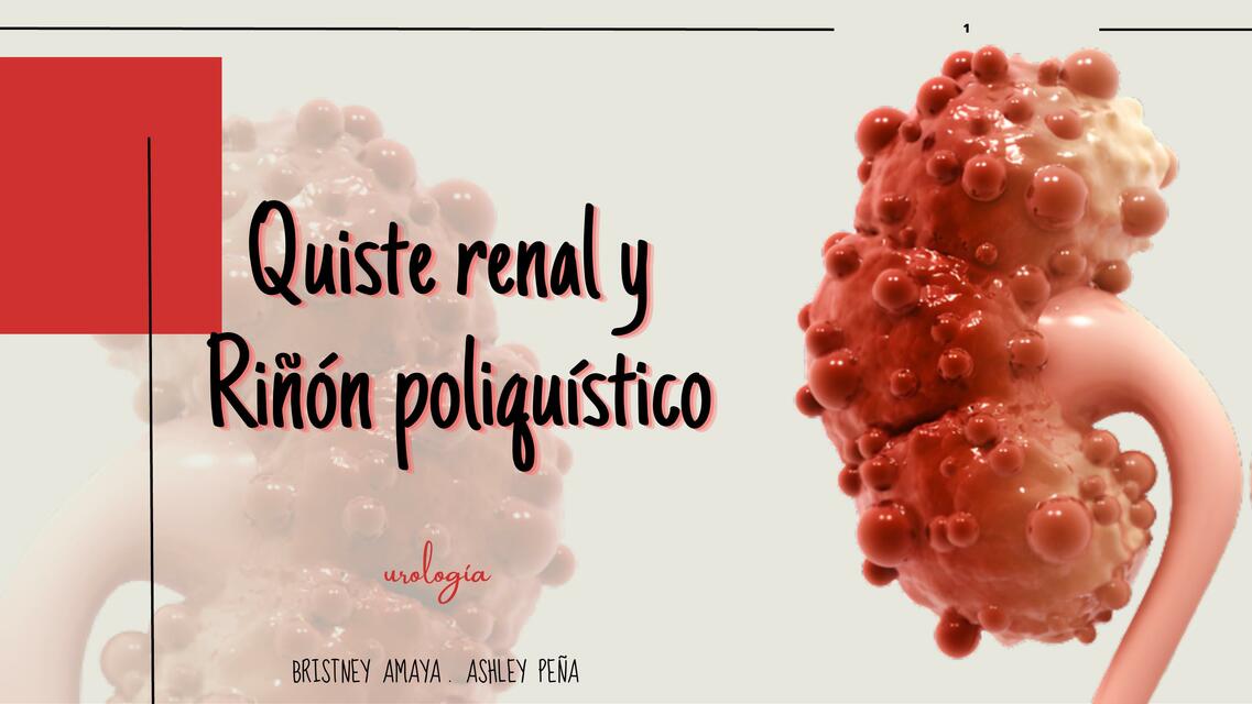 QUISTE RENAL Y RIÑÓN POLIQUÍSTICO