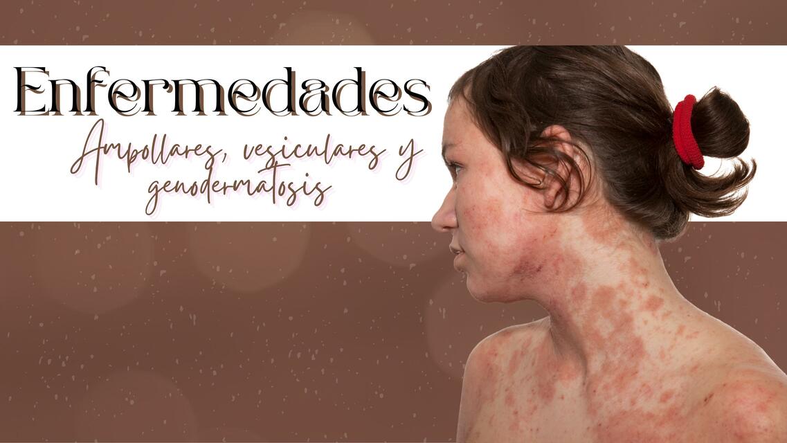 ENFERMEDADES AMPOLLARES VESICULARES Y GENODERMATOS