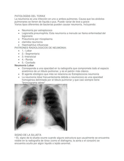 PATOLOGÍAS DEL TORAX