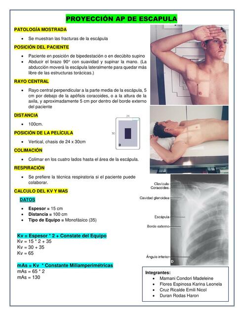 PROYECCIÓN AP DE ESCAPULA