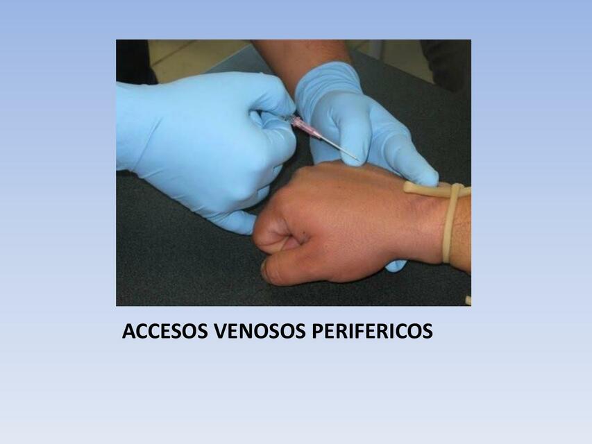 ACCESOS VENOSOS PERIFERICOS