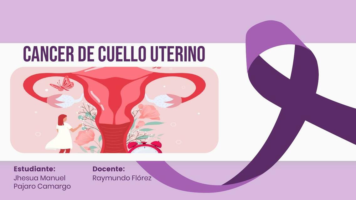 Cancer de cervix ginecologia