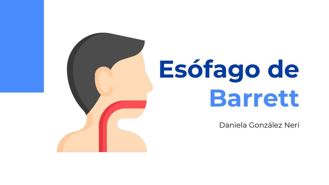 ESOFAGO DE BARRETT