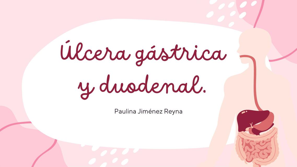 Úlcera gástrica y duodenal