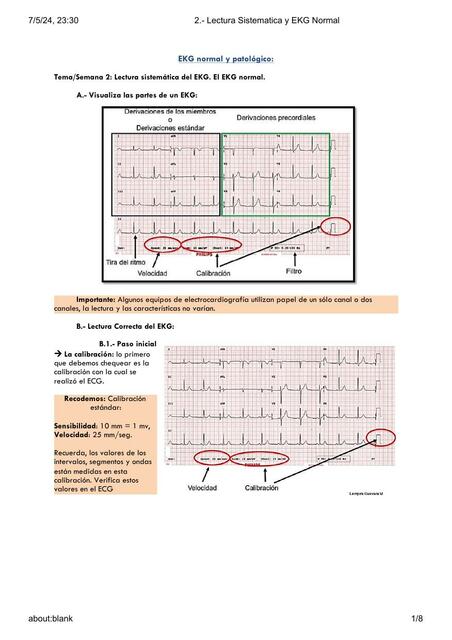 2 Lectura Sistematica y EKG Normal