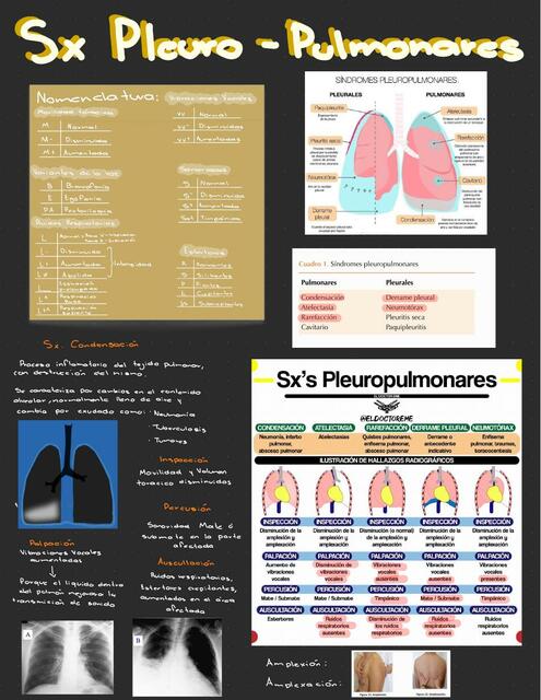 Apuntes Síndromes Pleuro Pulmonares