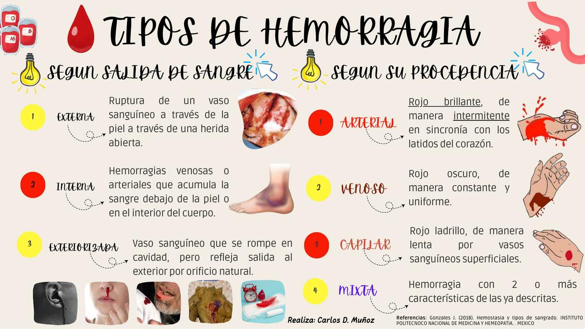 Tipos de hemorragia