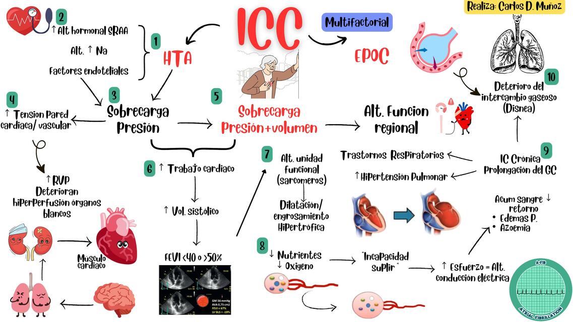 Fisiopatología Insuficiencia Cardiaca Congestiva (ICC)