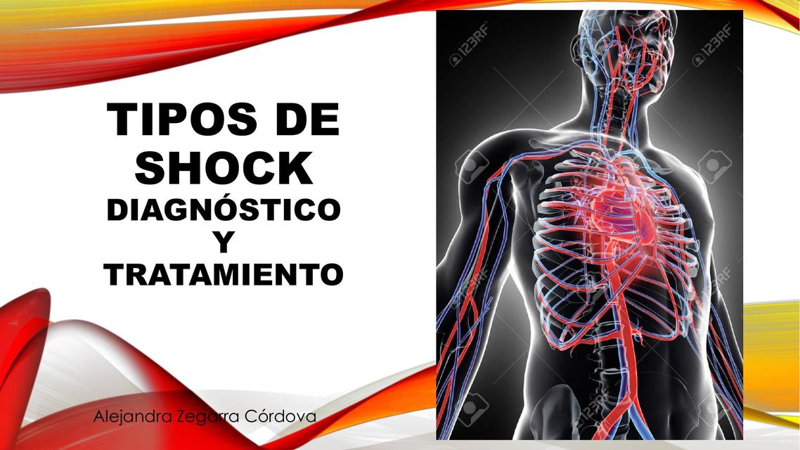 TIPOS DE SHOCK DIAGNÓSTICO Y TRATAMIENTO | DIAPOSITIVAS MEDICINA | uDocz