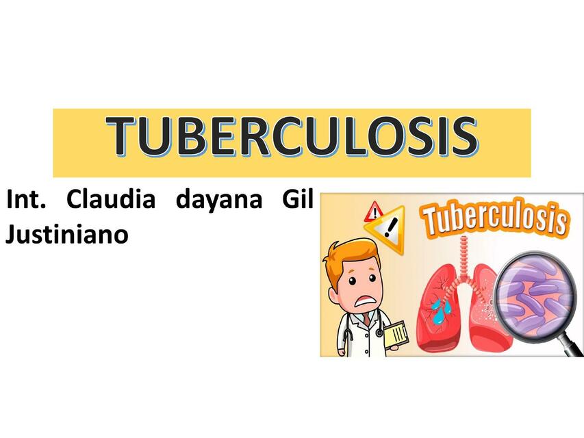 TUBERCULOSIS