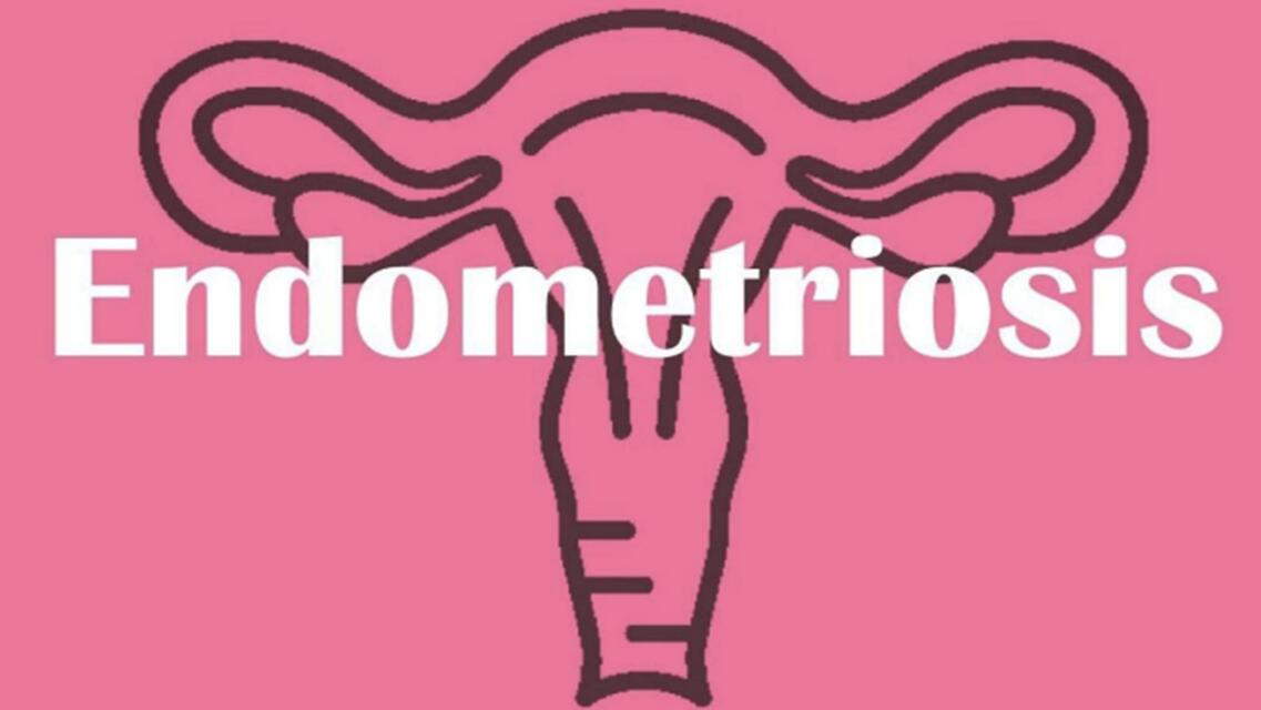 endometriosis