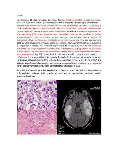 Informe S3 Parasitologia