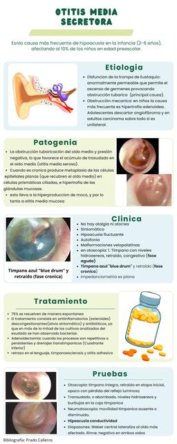 Otitis media secretora