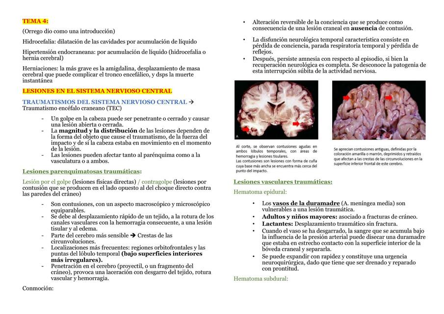 PATOLOGÍA - NEURO