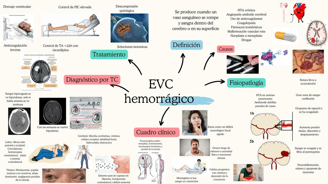 Mapa mental EVC Hemorrágico