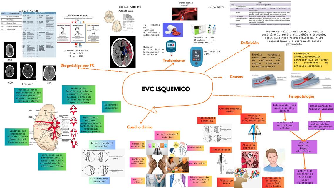 Mapa mental EVC Isquémico