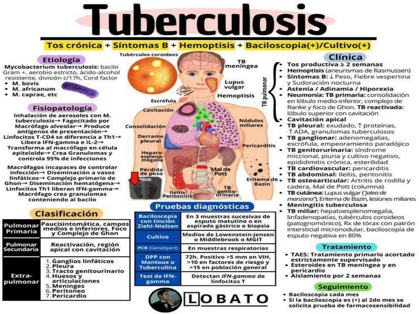 Tuberculosis