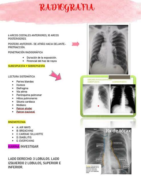 radiografia