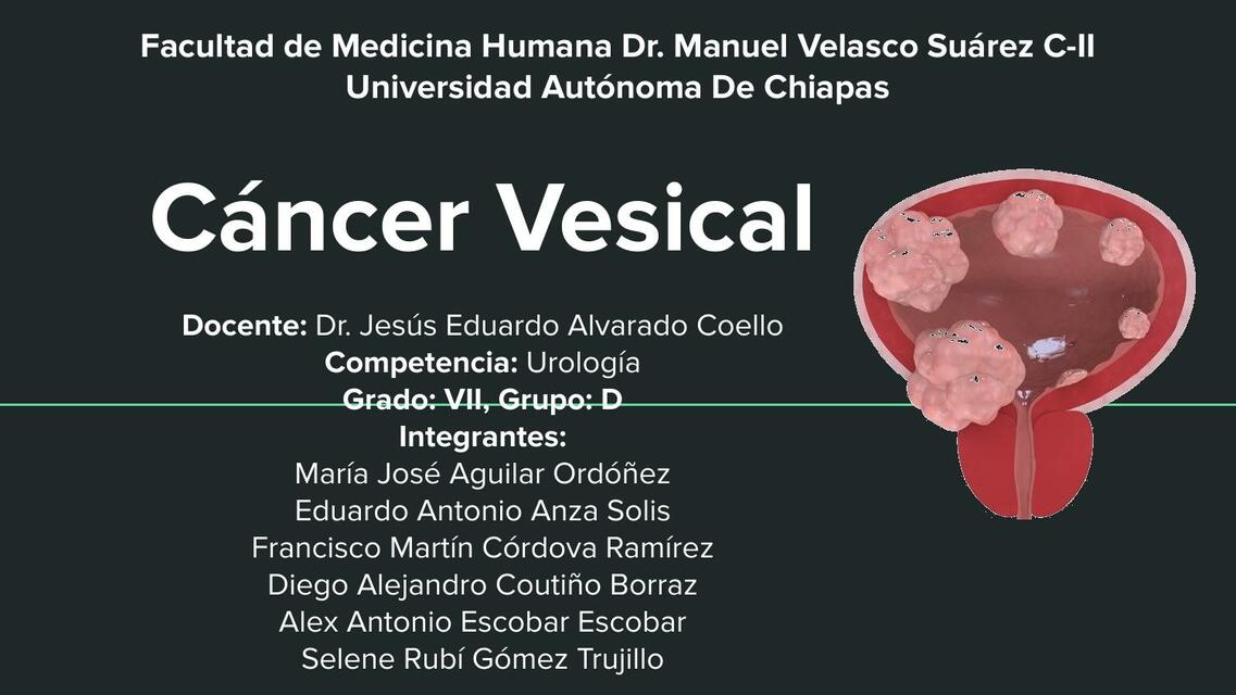 CANCER VESICAL UROLOGÍA