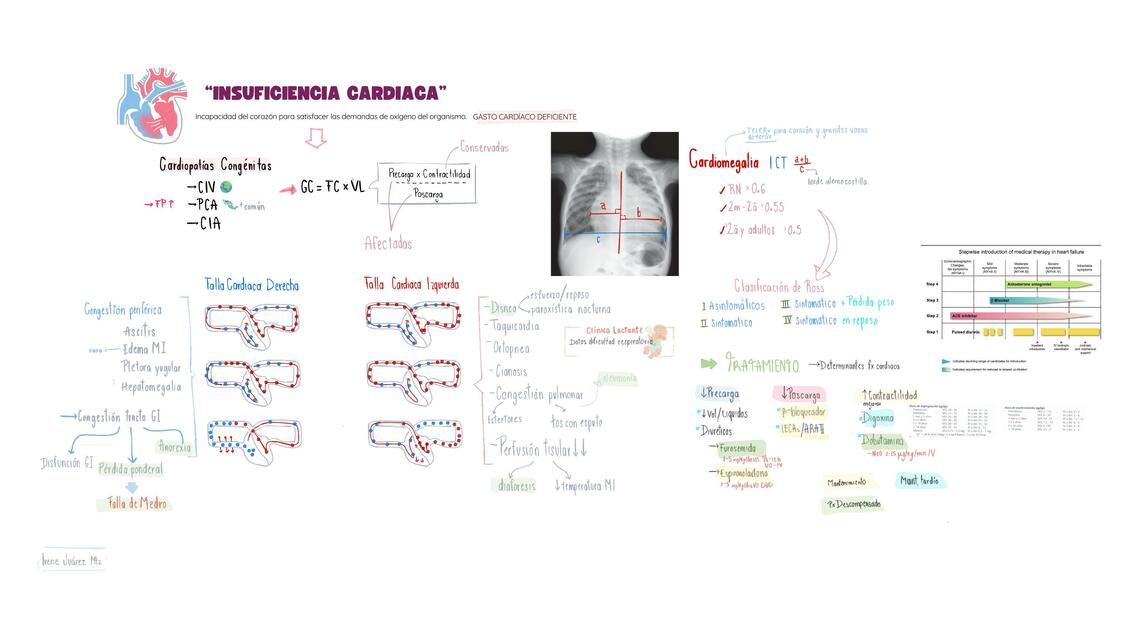 Insuficiencia cardiaca