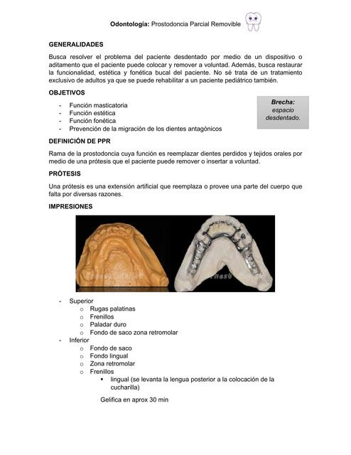 Apuntes de prostodoncia parcial removible prt 1