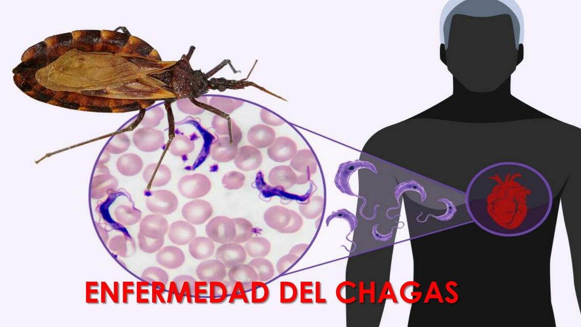 TEMA 14 CHAGAS